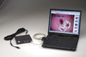 Image Capture System for Computer - Welch Allyn