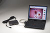 Image Capture System for Computer - Welch Allyn